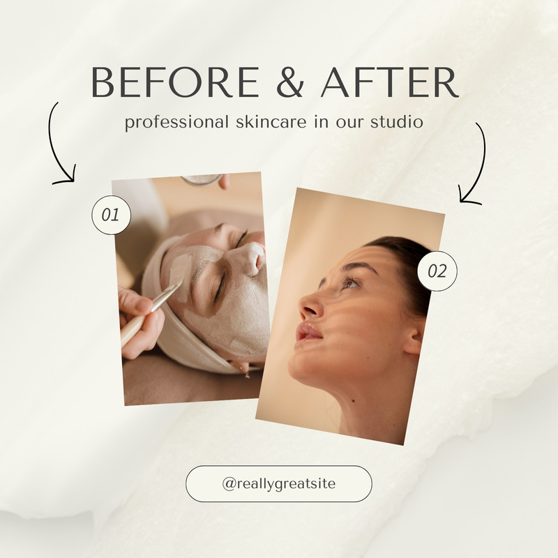 Free and customizable before and after templates