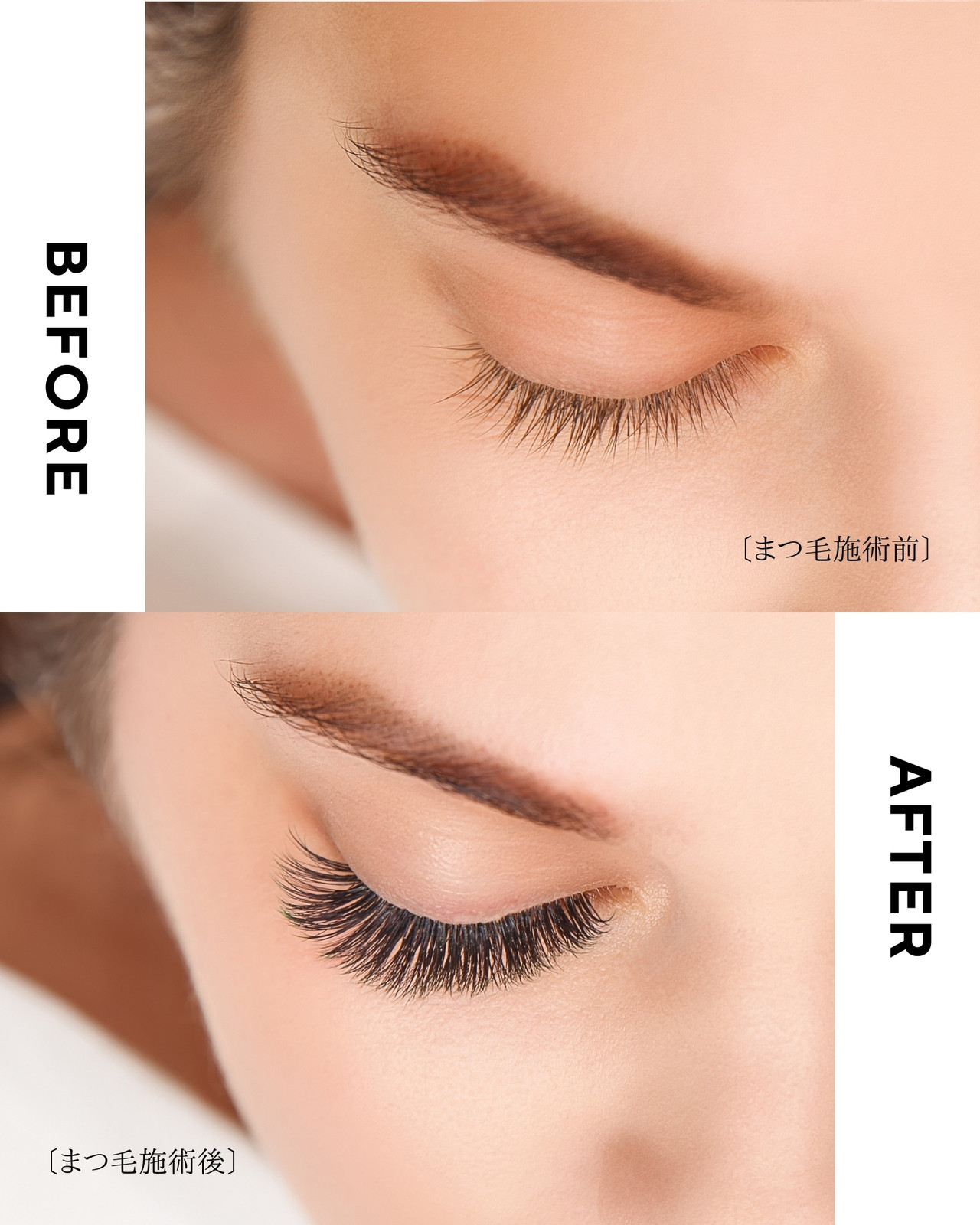 白  ベーシック 施術後の変化 比較 Instagram投稿 4:5 (1080 x 1350px)