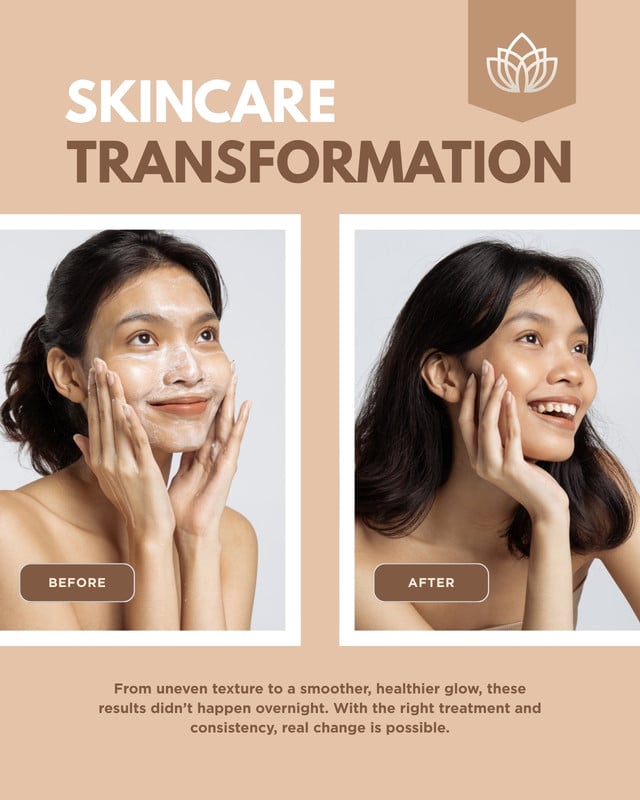 Transformation Post Example Free and customizable transformation templates